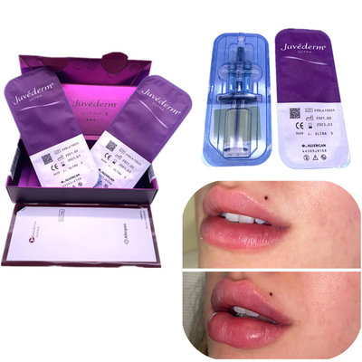 Injection Ha Filler Juvederm 2x1ml Wzmocnienie ust Usuń zmarszczki