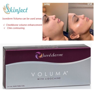 Pielęgnacja twarzy 2x1ml Juvederm Lip Fillers Kwas hialuronowy Dermal Injectable
