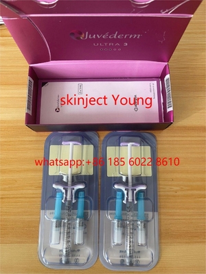 Juvederm Ultra 3 2x1ml Kwas hialuronowy Linie twarzy Wypełniacze skórne na zmarszczki