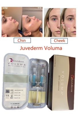 Juvederm Voluma Wypełniacz z usieciowanym kwasem hialuronowym Long Lasting Face Pure Injectable