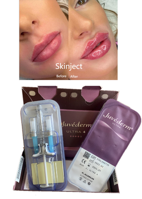 Lips Reshape Juvederm Wypełniacz skórny z kwasem hialuronowym z Lido Ultra4 2X1ml