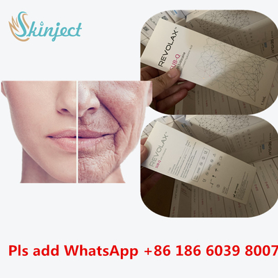 Wypełniacz długopisu z kwasem hialuronowym KOEAR Revolax Kwas hialuronowy Dermal Facial Plastic