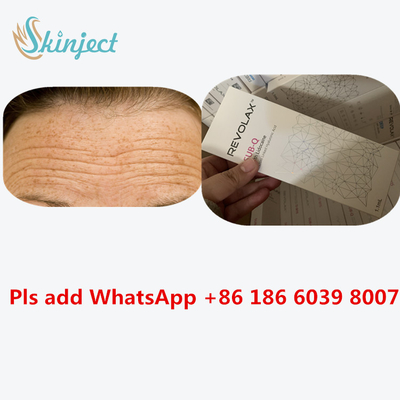 Kwas hialuronowy Dermal Revolax Deep Filler 1ml do iniekcji ust
