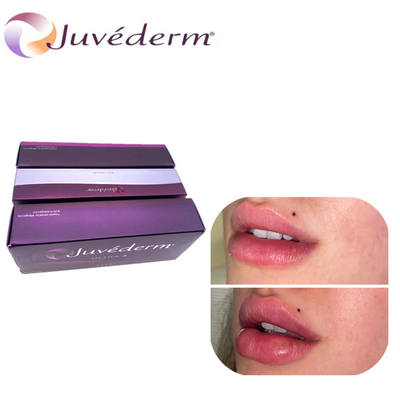 Juvederm kwas hialuronowy powiększanie warg wypełniacz skórny nos wyciągacz wypełniacz trwa na twarz