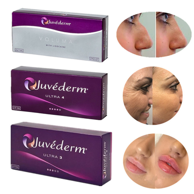 Juvederm 8-12 miesięcy Wypełniacz skórny z kwasem hialuronowym Rewolucyjny produkt do wstrzykiwań