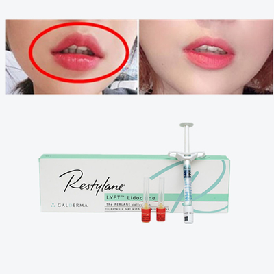 Vital  Perlane Cross Linked Dermal Filler kwas hialuronowy