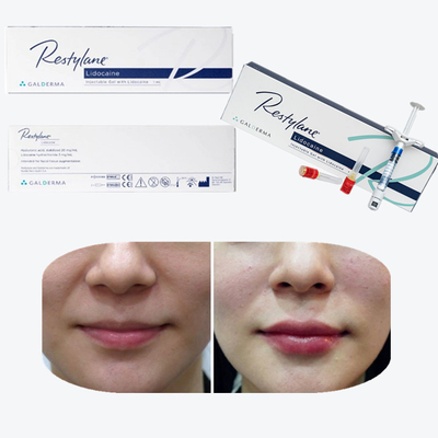 Juvederm Cross Linked Injectable Dermal Filler dla warg