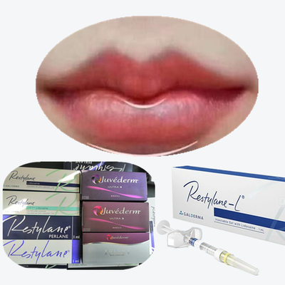 Juvederm Cross Linked Injectable Dermal Filler dla warg