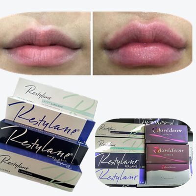 2*1 ml/ pudełko Filler skórny z kwasem hialuronowym do powiększania warg