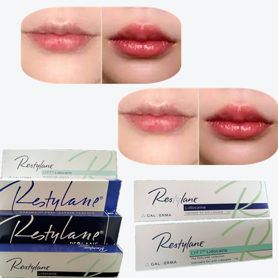 2*1 ml/ pudełko Filler skórny z kwasem hialuronowym do powiększania warg