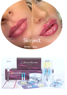 Juvederm kwas hialuronowy wypełniacz skóry do twarzy do wstrzykiwań 2*1 ml Opakowanie
