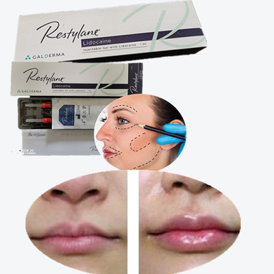 Injectable Dermal Filler HA Fillers Injection for Face Anti-Aging
