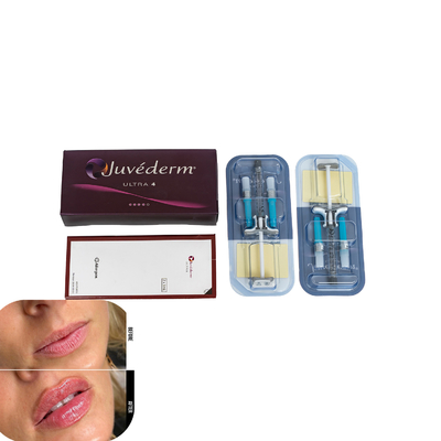 Juvederm wypełniacz skórny do ust Wstrzykiwacz kwas hialuronowy wypełniacz