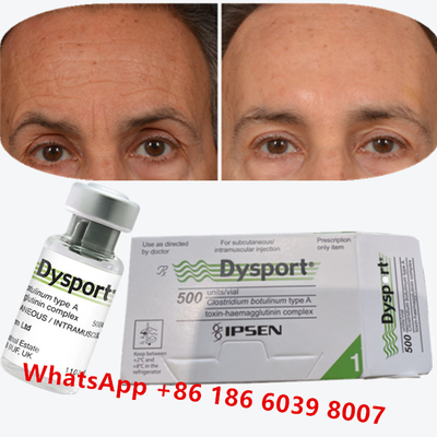Toksyna botulinowa Dysport Clostridium Botulinum Typ A