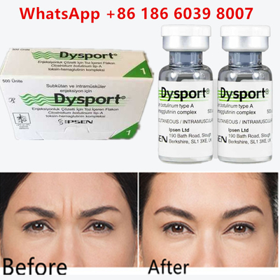 Toksyna botulinowa dysport 100u Clostridium botulinum typu A