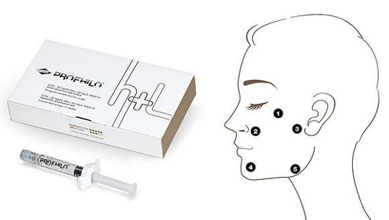 Profhilo H L 2 ml kwasu hialuronowego o stężeniu 32 mg/ml Ha