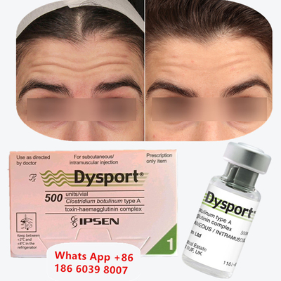 Toksyna botulinowa A Dysport Botox wstrzyknięcie na zmarszczki wokół ust