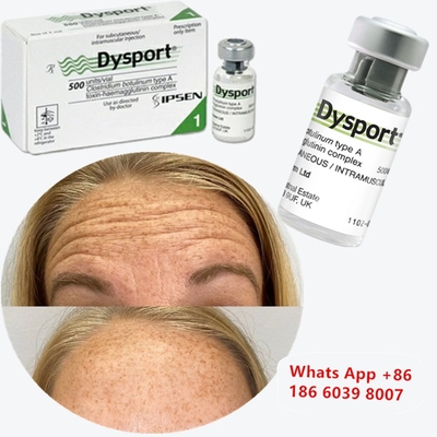 Dysport toksyny botulinowej Clostridium botulinum typu A Do korekty nosa