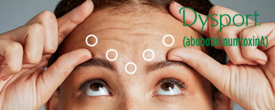 Dysport 500 do wstrzykiwań abobotulinumtoxinA Botox 500U