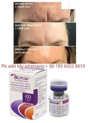 Allergan Botox 100IU Dysport Iniekcja Toksyna Botulinowa Botulax Usuwanie Zmarszczek