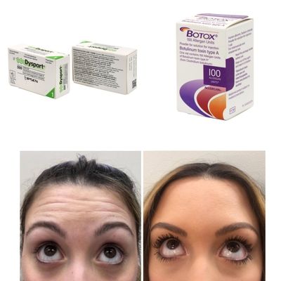 100 jednostek Korea BTX Toksyna botulinowa na zmarszczki i drobne linie