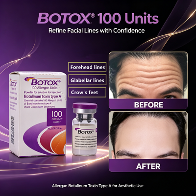 Botox 100 jednostek Wstrzyknięcie przeciwzmarszczkowe Leczenie estetyczne twarzy Alergan toksyna botulinowa typu A