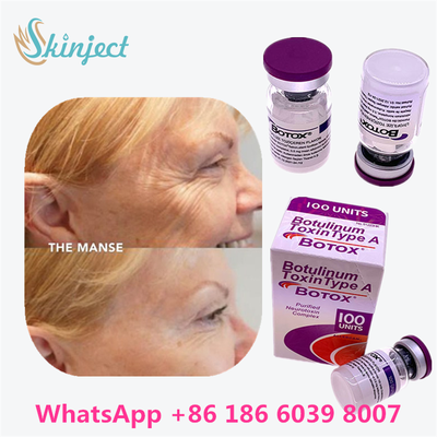 Toksyna botulinowa BOTOX Cosmetic 100 jednostek Allergan OnabotulinumtoxinA na zmarszczki mimiczne