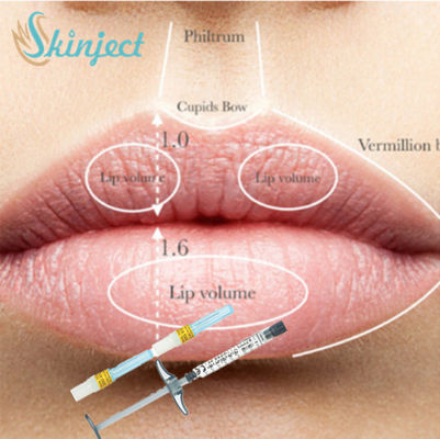 Full Lip Cheek Injectable Dermal Filler Kwas hialuronowy HA Filler 1ml 2ml 5ml