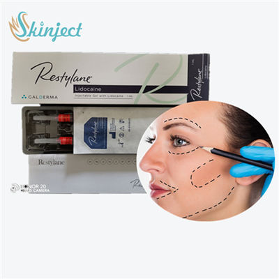 Dermal Filler Lip Injections, 1 ml wypełniaczy z kwasem hialuronowym