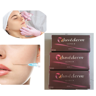 Zastrzyk Juvederm 2x1ml Ultra 3 Lip Dermal Filler 24mg/ml