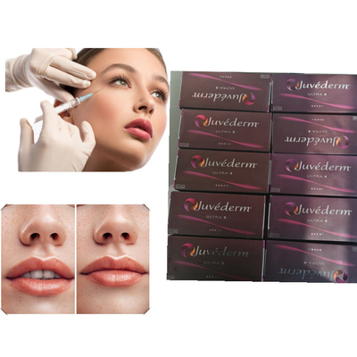Lip Gel Filler Kwas hialuronowy Wypełniacz skórny Juvederm Ultra 3 Ultra 4