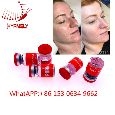 Anti Aging Meso Serum Wstrzyknięcie Z Wypełniaczem Skórnym Hialuron Pen