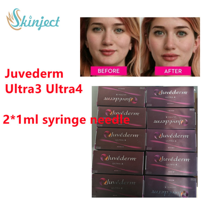Juvederm Wypełniacz skórny z kwasem hialuronowym Juvederm Wypełniacz do ust z lidokainą 2x1ml Ultra3 Ultra4