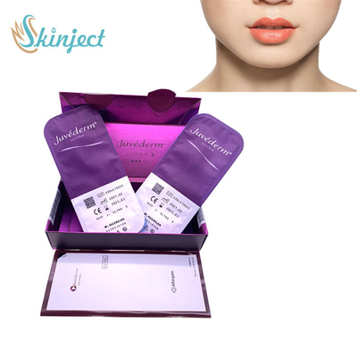 2x1ML Juvederm Ultra3 Wypełniacz skórny z kwasem hialuronowym do twarzy