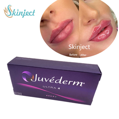 Juvederm 2*1ml wypełniacz do ust kwas hialuronowy wypełniacz skórny z Lido Ultra4