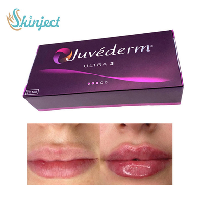 281 ml wypełniacz do ust z kwasem hialuronowym Juvederm Ultra3 Dermal