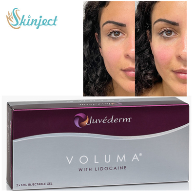 Juvederm Voluma 2x1ml HA Dermal Fillers do konturowania podbródka kości policzkowej