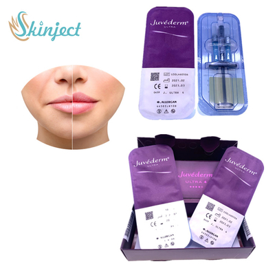 Juvederm Ultra4 Lip Enlargement Wypełniacze skórne Kwas hialuronowy