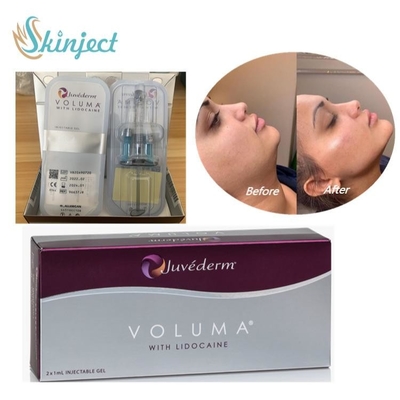 Juvederm Voluma Dermal Filler Kwas hialuronowy do konturu twarzy policzków i podbródka