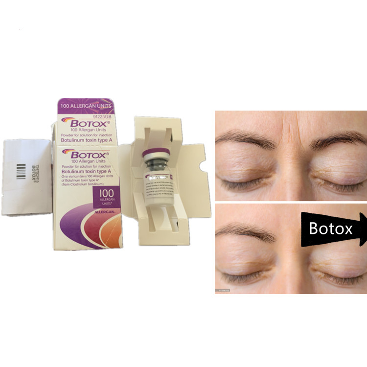 Allergan 100ui Serum Toksyny Botulinowej Produkt przeciw starzeniu