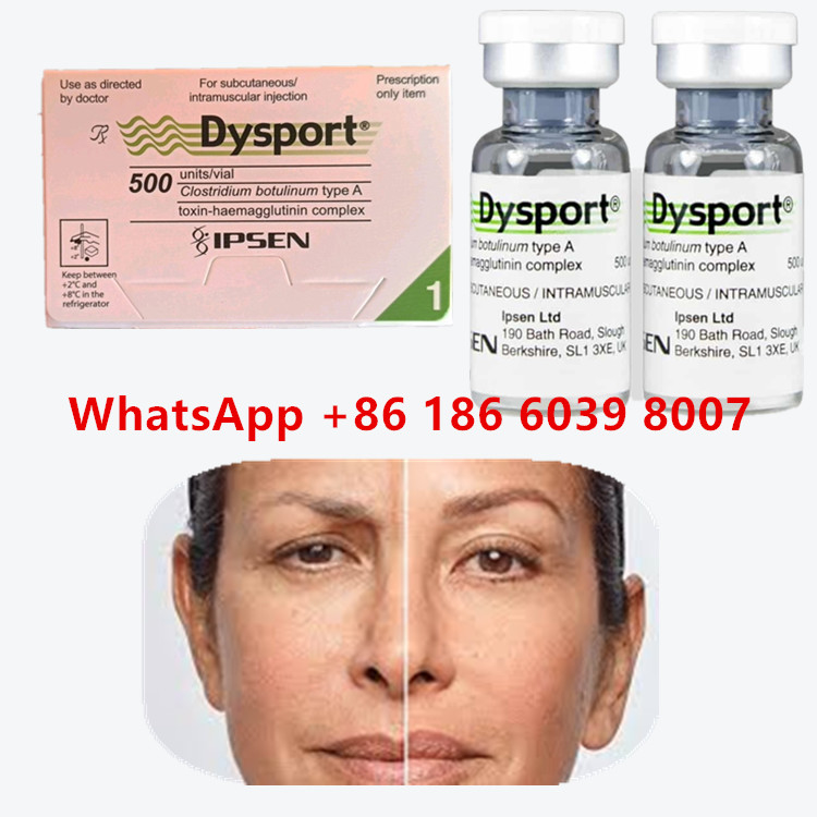 Toksyna botulinowa Dysport 100u Clostridium Botulinum Typ A