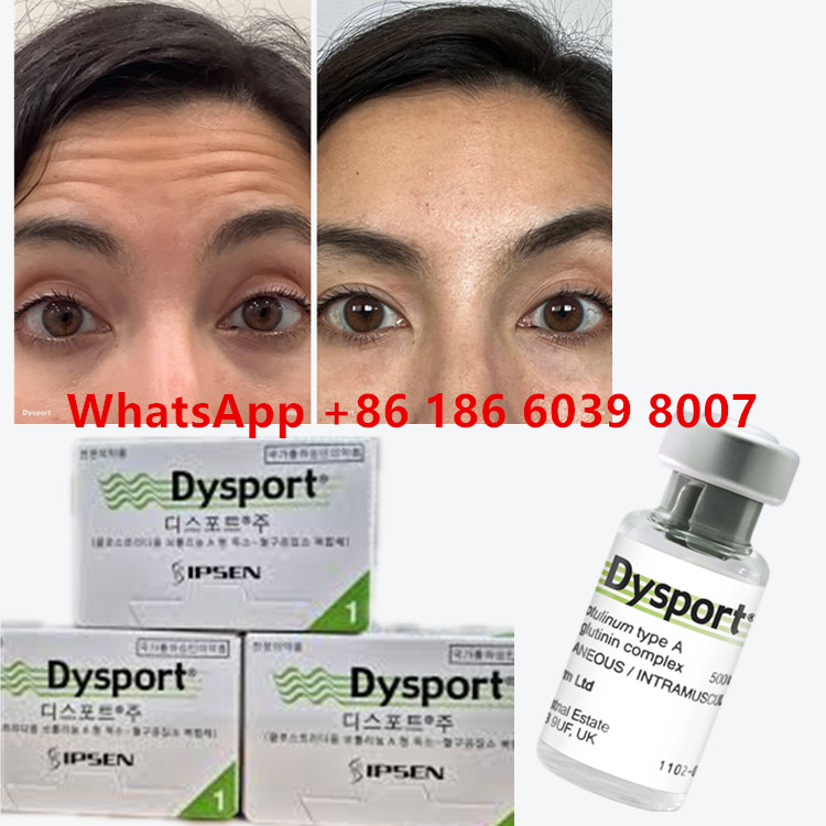 Toksyna botulinowa dysport Clostridium Botulinum typ A 500 jednostek/ fiolkę