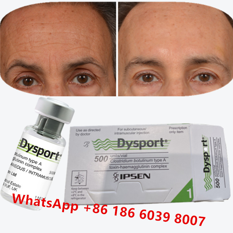 Toksyna botulinowa Dysport Clostridium Botulinum Typ A