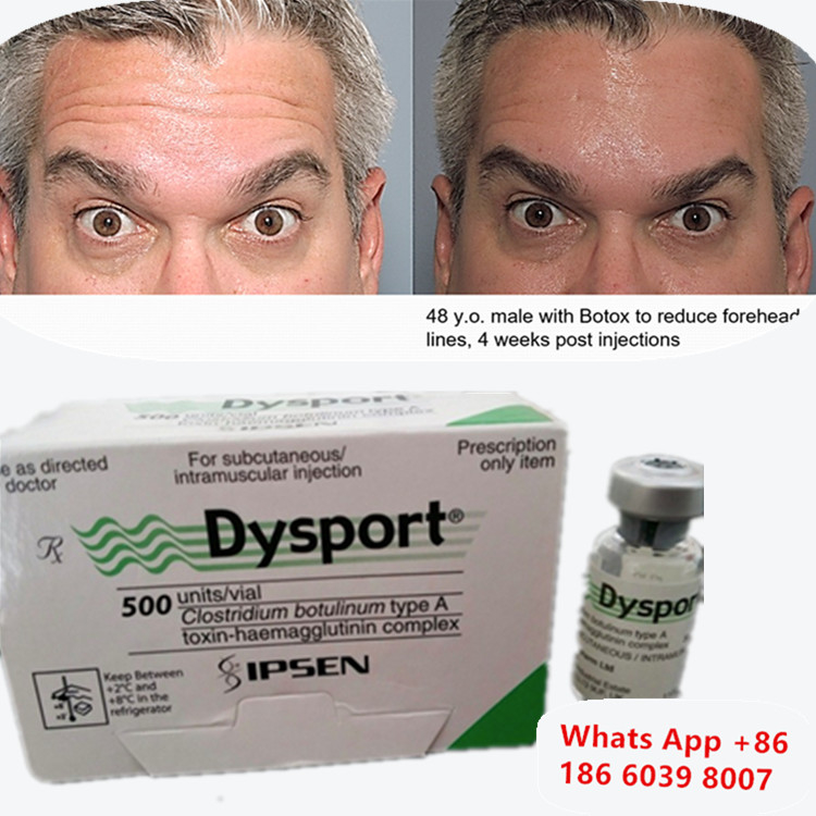 Toksyna botulinowa Dysport Botox Clostridium Botulinum Typ A do podnoszenia brwi