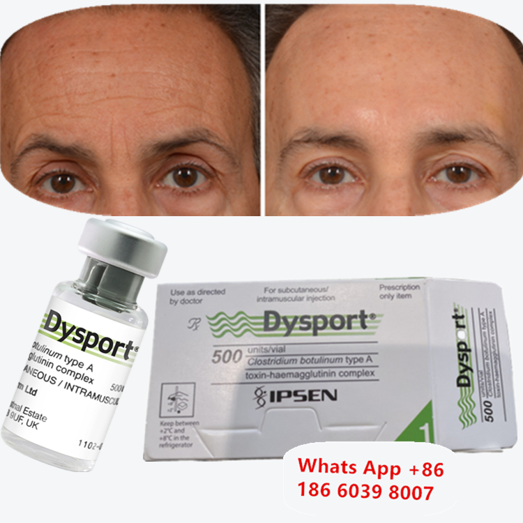 Toksyna botulinowa Dysport Botox Powód przeciwzmarszczkowy do domku pary