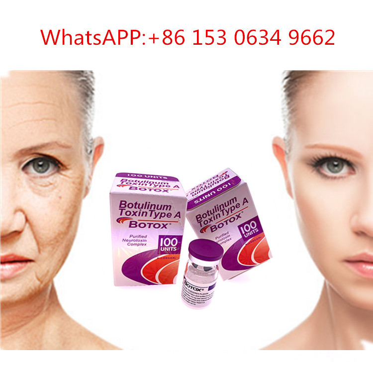 50u 100u 150u Typ A Allergan  Injection Toksyna botulinowa przeciw zmarszczkom
