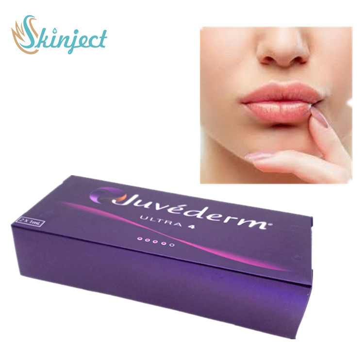Juvederm Ultra 4 Wypełniacz skórny do ust Wypełniacz skórny Wypełniacz skórny z kwasem hialuronowym