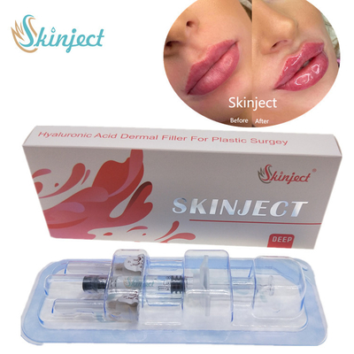 Skinject Deep Hialuronic Acid Dermal 2ml Lips Fillers Injectable