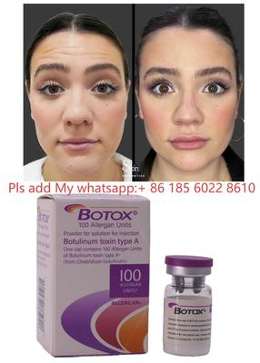 Toksyna botulinowa Botulax Dysport Allergan Botox do redukcji zmarszczek i kosmetyki
